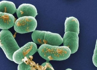 Afrique du Sud : Le pays subit la plus importante épidémie de listériose de l’histoire