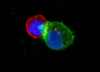 Cancer du sein : Une très bonne nouvelle