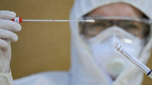 coronavirus-pourquoi-les-tests-de-depistage-ne-sont-pas-toujours-efficaces