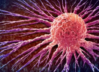 Etude: Le cancer chez les moins de 50 ans en hausse dans le monde