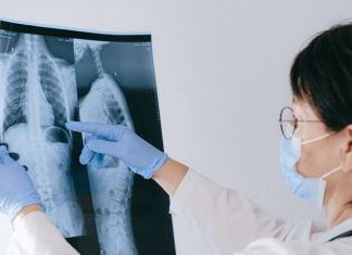 Tuberculose: le ministère de la Santé prépare une large campagne de sensibilisation
