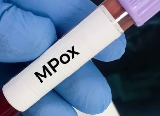 Mpox: aucun cas détecté au Maroc depuis des mois (source autorisée)